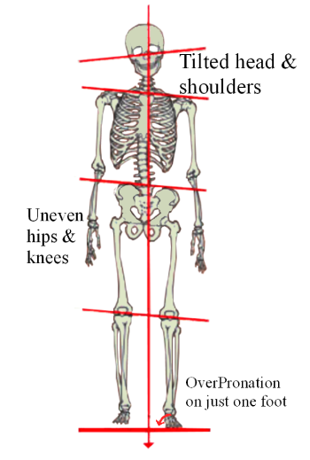 Leg Length