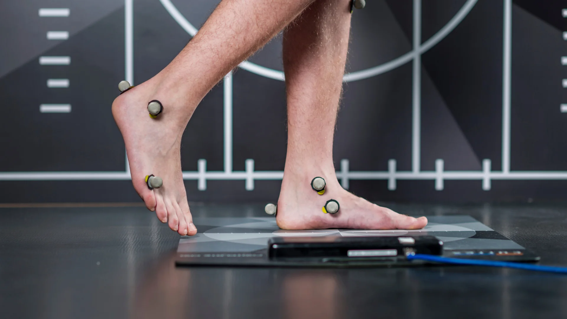 Feet with motion-tracking markers during a gait assessment